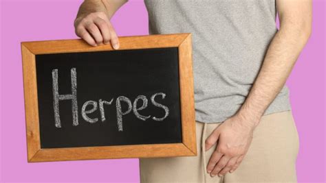 simptome herpes genital|Genital Herpes: Symptoms, Treatment, and Management Guide